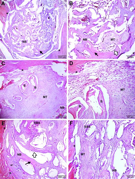 Histological Findings Of Bone Defect After 21 Days A And B Represent Download Scientific