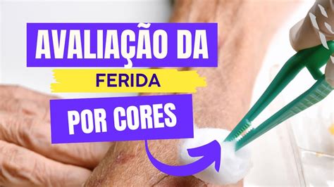 avaliacao da ferida por  youtube