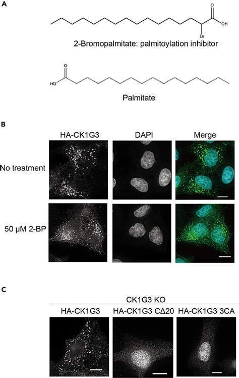 A Palmitoylation Inhibitor Redistributes Ck G From The Punctate