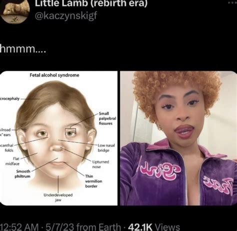 Ice Spice Down Syndrome Theory Know Your Meme