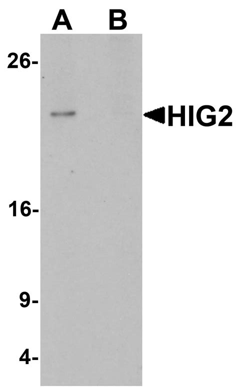 Anti Hilpda Hig2 Antibody Rabbit Anti Human Polyclonal Elisawb Lsbio