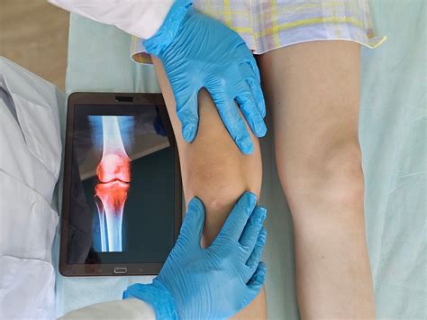 Meniscus Tear vs. ACL Injury