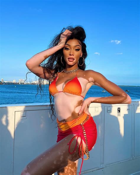 Winnie Harlow Spread Her Legs Wide In Tiny Bikini Photos The Fappening