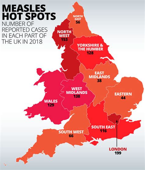 Measles symptoms: Virus signs include rash after UK outbreak warning ...