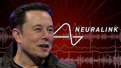 Elon Musk Dice Que Un Paciente Con Chip Cerebral Puede Controlar Un