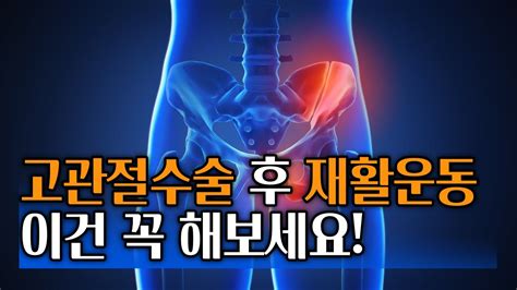 고관절 수술 후 재활운동 Youtube