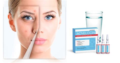 Препарат Акнелоцин (Acnelocin) от прыщей, цена, отзывы, где купить ...