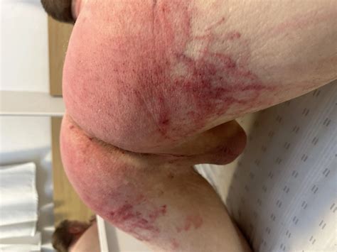 My Ass Being Whipped By My Master Pics Xhamster