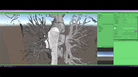 Volume Rendering In Unity Teaser Want More Content On This YouTube