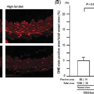 Comparison Of Vascular Relaxation Of Aortic Ring To Acetylcholine And