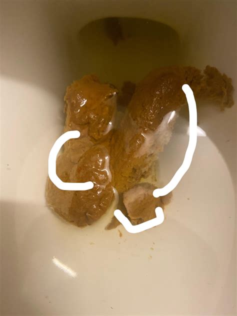 mucus  stool  blood rpoop