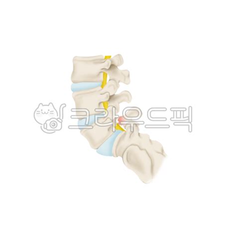 anatomy nchuccida