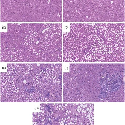 Representative H E Stained Liver Sections A Control Acd B Acd Aq