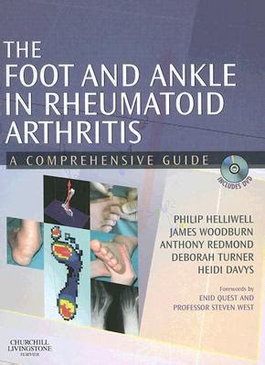 The Foot And Ankle In Rheumatoid Arthritis A Comprehensive Guide By