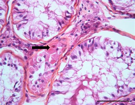 Testicular Section Magnification On Hematoxylin Eosin Staining Of The