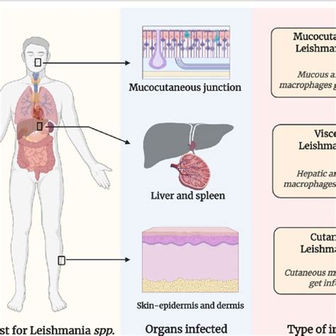 Types Of Leishmaniasis And The Organs Affected Mucocutaneous