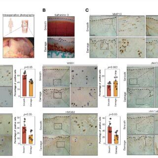 The Expression Of Key Leading Edge Proteins In The Human Knee Cartilage