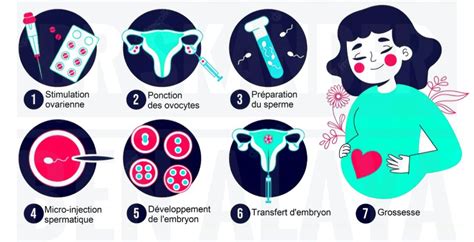 Injection Intra Cytoplasmique De Spermatozo De Icsi Imsi