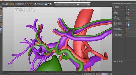 Tvasurg Process 3d Modelling Tvasurg The Toronto Video Atlas Of Surgery