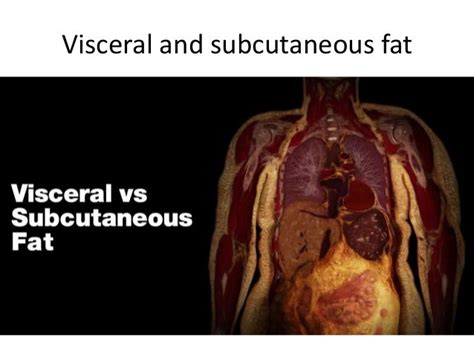 Visceral fat