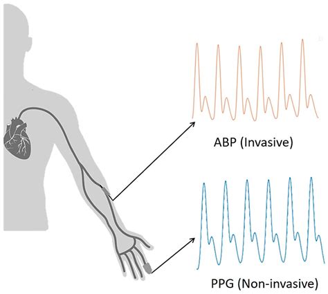 Labyrinth Human Great Invasive Blood Pressure Monitoring Detector