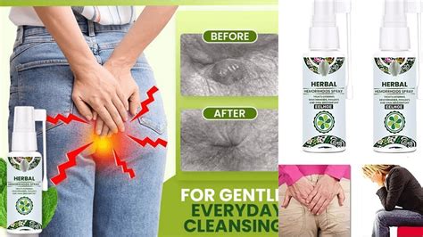 Natural Herbal Hemorrhoids Spray 2021 Hemorrhoids Treatment At Home