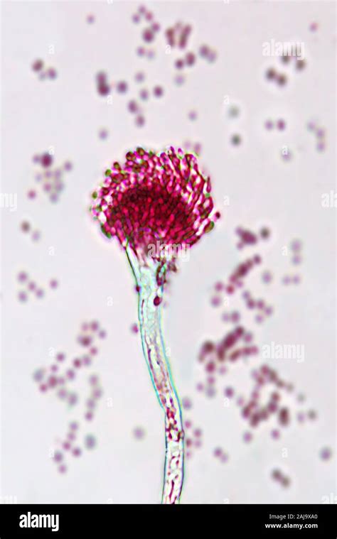 Aspergillus Fumigatus Hi Res Stock Photography And Images Alamy