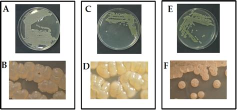 Actinomyces Colony Morphology
