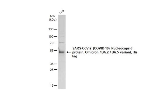 SARS CoV 2 COVID 19 Nucleocapsid Protein Omicron BA 2 BA 5