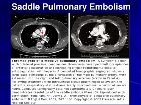 PPT - Hemodynamic Monitoring for the Respiratory Therapist PowerPoint