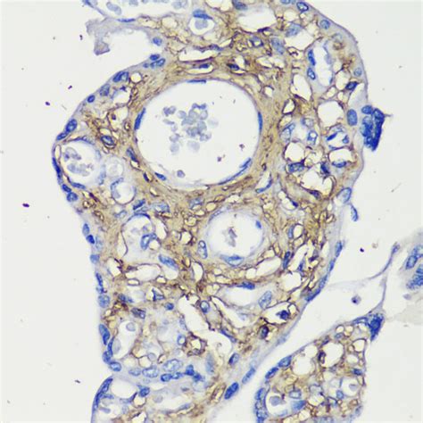 DCN Antibody SAB Signalway Antibody