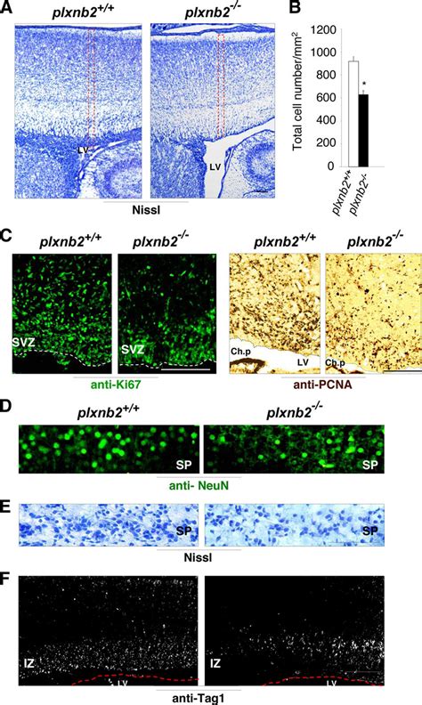 Proliferation Defects In The Developing Cp Of Mice Lacking Plexin B