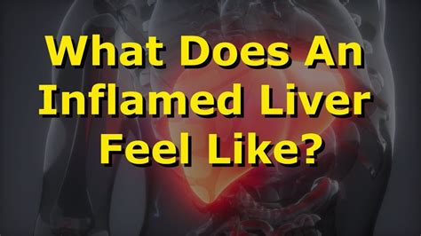 What Does An Inflamed Liver Feel Like Youtube