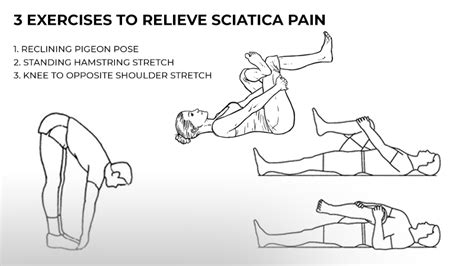 how to cure sciatica permanently at home