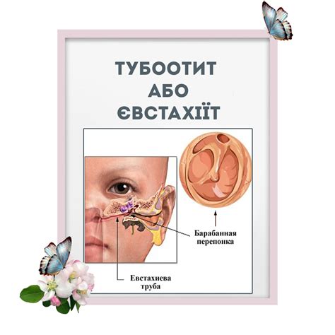 Тубоотит або євстахіїт | Клініка Сміянових