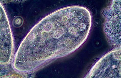 Protozoários São Eucariontes - Protista | Reino protista, Eucariontes, Protozoários