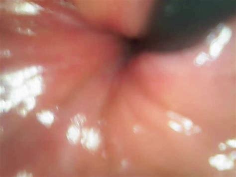 Endocam Inside My Ass Thisvid