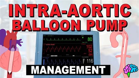 Management Of The Intra Aortic Balloon Pump Iabp Youtube