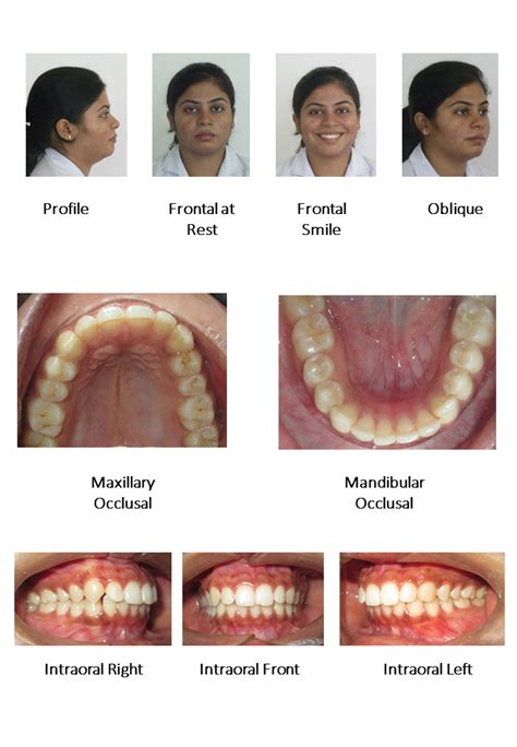 Dentosphere World Of Dentistry Photographs In Orthodontics Dental