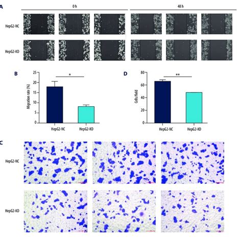 Migration And Invasion In Hepg Cells After Knockdown Of Hhla A B