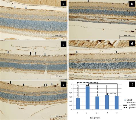 A Light Microscopic Examination Of Immune Histochemical Staining