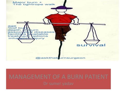 Management Of A Burn Patient Ppt