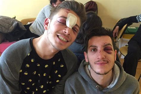 Terribile Aggressione A Milano Due Ragazzi Gay Massacrati A Calci E Pugni Da Uomini Gay It