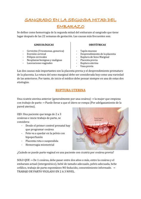 Sangrado En La Segunda Mitad Del Embarazo Sangrado En La Segunda