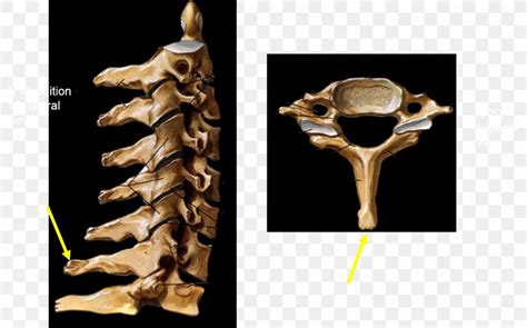 Vertebra Prominens Vertebral Column Cervical Vertebrae Sacrum, PNG ...