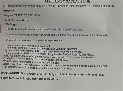 How serious is this L4-L5 disc bulge? : r/backpain