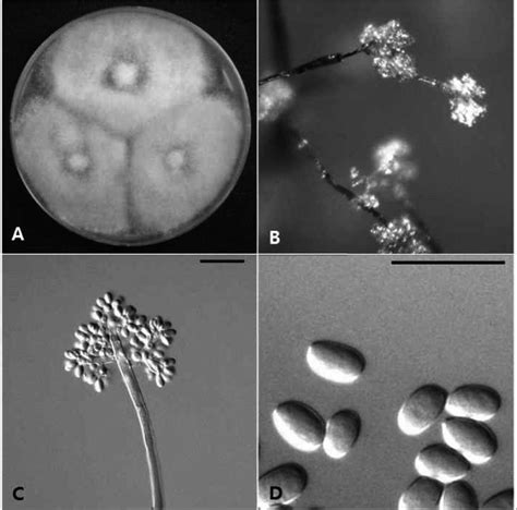 Morphological characteristics of Botrytis cinerea KACC 47009 isolated... | Download Scientific ...