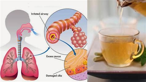 How To Get Rid Of Phlegm And Mucus In Chest And Throat Youtube