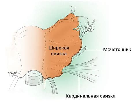 Параметрит: причины, симптомы и лечение в статье гинеколога Окунев А. А.