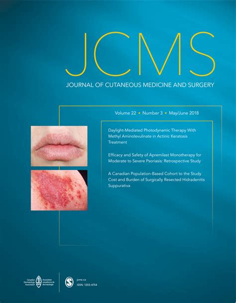 Case Report Of A 21 Year Old Man With Epidermolysis Bullosa Acquisita Janelle Cyr Annie Liu